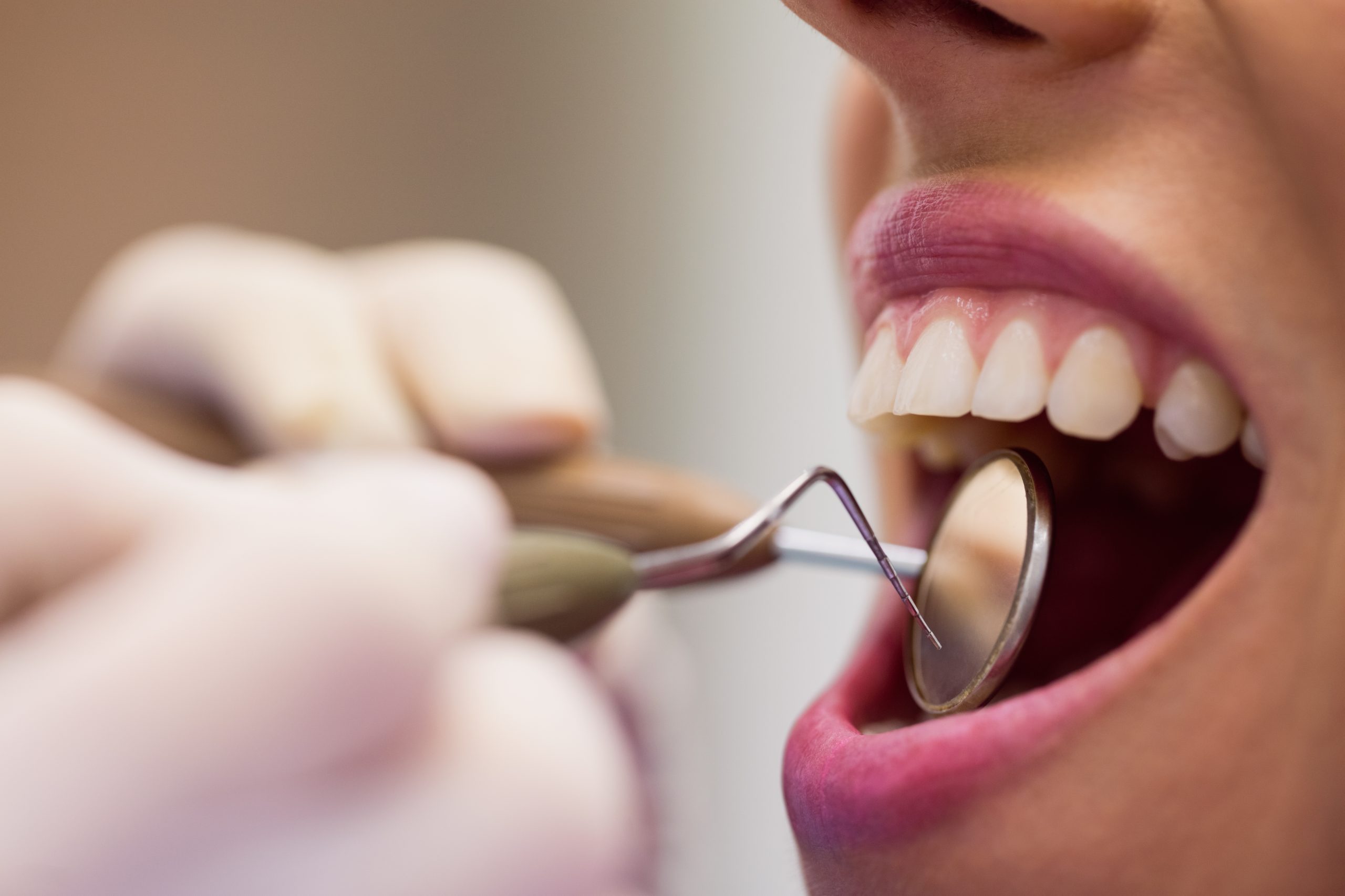 La importancia de acudir a una clínica dental de calidad contrastada